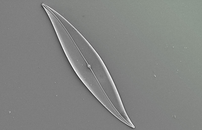 Diatom through microscope